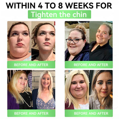 Daily Slim Patch — Melt Fat, Boost Metabolism!