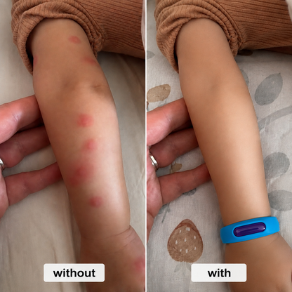 Natural Mosquito Repellent Bracelet