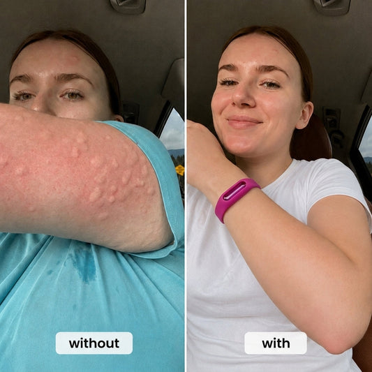 Natural Mosquito Repellent Bracelet